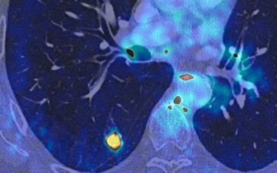 Imagerie médecine nucléaire CEI