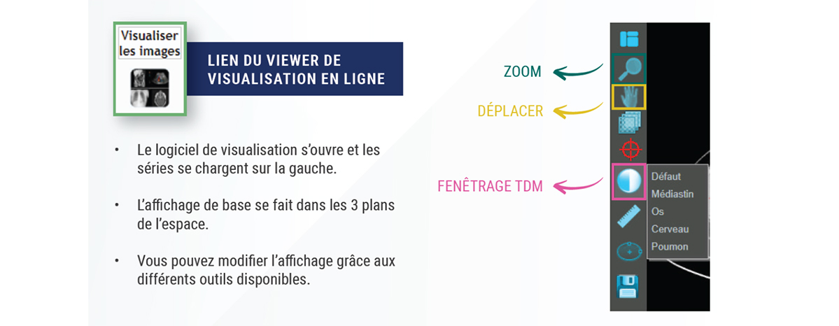 tuto-viewer-pacs-2