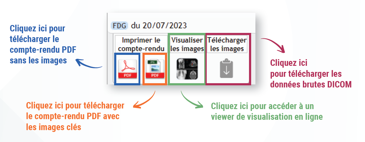 tuto-viewer-pacs-1