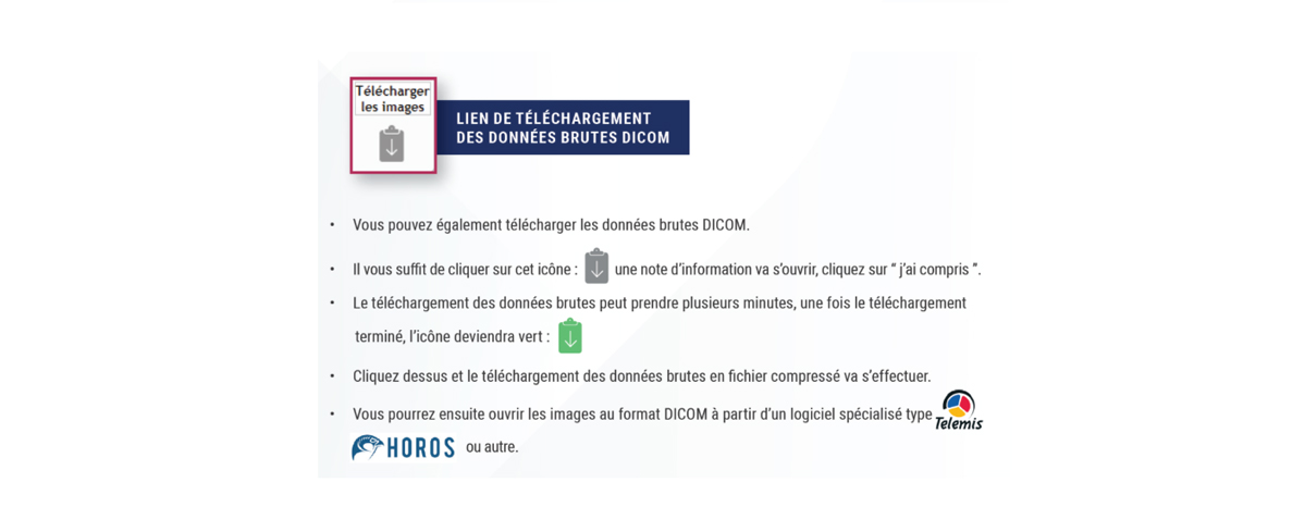 tuto-viewer-pacs-4