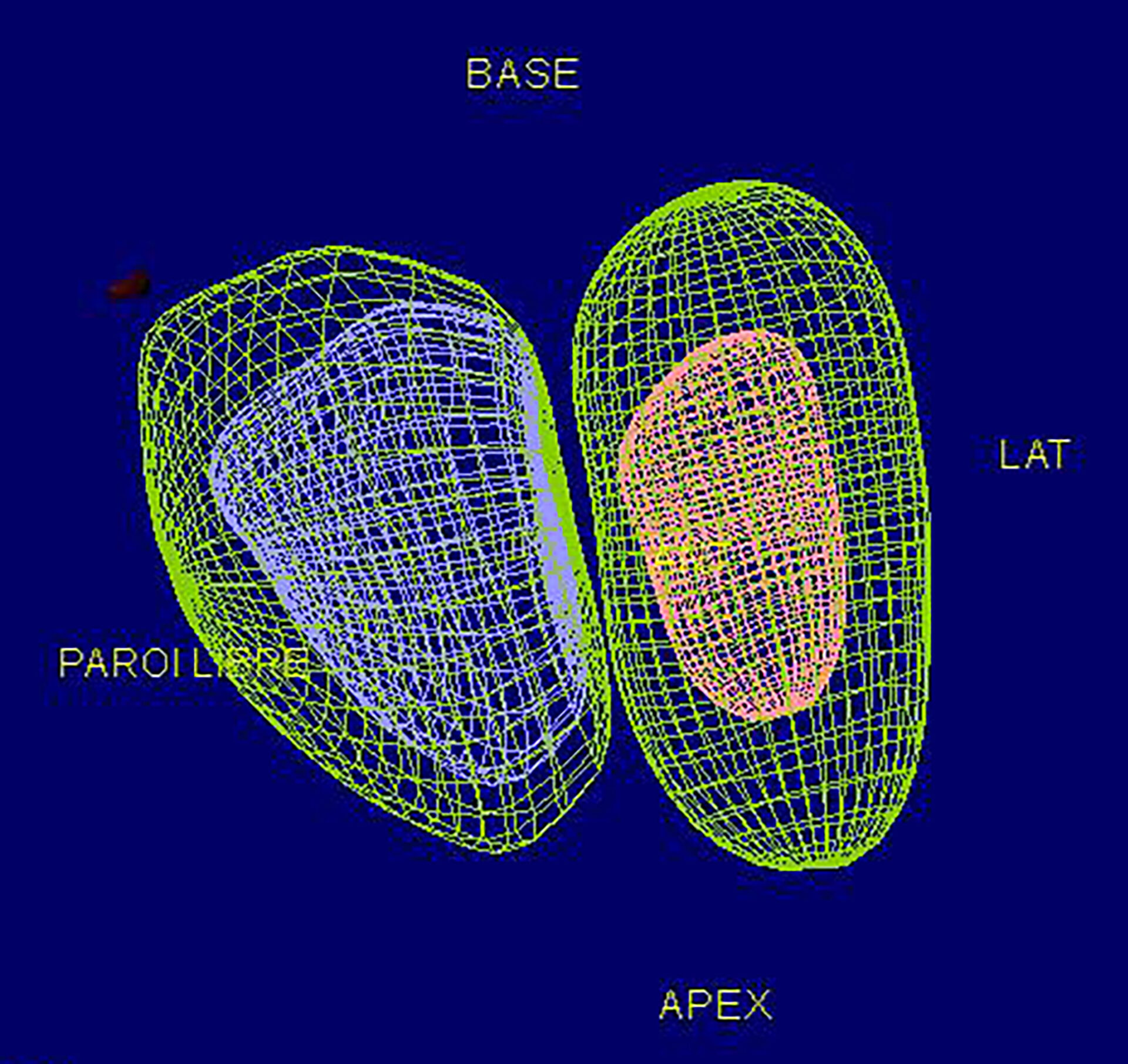 fraction d'éjection