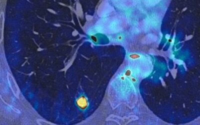 Imagerie médecine nucléaire CEI
